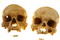 L'étude ostéologique en laboratoire des crânes de la nécropole mérovingienne de Ligny-le-Châtel (Yonne) fouillée en 2005.