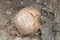 Détail du crâne d'un enfant âgé de 2 ans et demi d'après les mensurations des os, surmonté d'un ensemble de bracelets en schiste et en bronze, dans une sépulture du cimetière d'enfants de l'âge du Fer  à Jort (Calvados) 